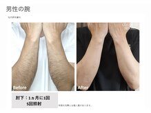 リネ(Rine)/before→after