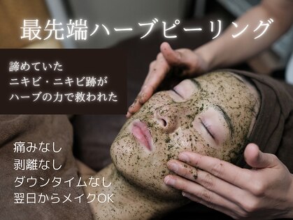 クロシェの写真
