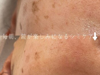 サロンドシエル カスガイ(Salon de Ciel kasugai)/鏡を見るのが好きになるシミケア