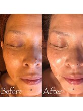 エステサロン マコ(MaCo)/60代・たるみケア