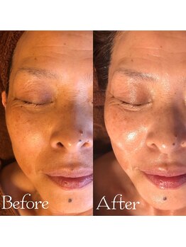 エステサロン マコ(MaCo)/60代・たるみケア