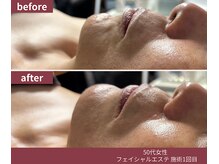 ウェルネス ステーション リンク(Wellness Station Link)/ビフォーアフター