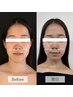【本来の美しさ】頭皮から引き上げる小顔ヘッドスパ