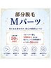 部分脱毛　Mパーツ