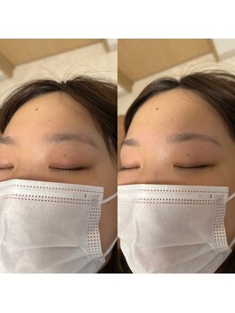 サロンドエピレーション トパーズ(Salon d’ epilation TOPARDS)/眉毛メンテナンス