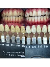 トウキョウスワーズ 池袋店(TOKYO SWRS)/#ホワイトニング #池袋 #渋谷