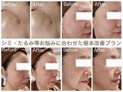 スリース(threes)の写真