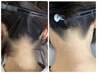 【至福の全顔脱毛】高保湿パック＋嬉しいうなじ付《3600→2980》