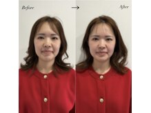 パール(Pearl)の雰囲気（寝落ち体験/知らぬ間に深い眠りへ/寝ている間に小顔を叶えます♪）