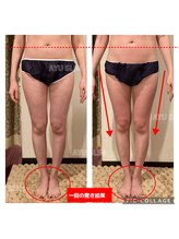 アユスリム(AYU SLIM)/施術一回目から結果出します!