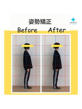 ケンゾー接骨院(KENZO接骨院)/姿勢改善