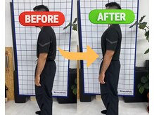 ハビジム(HabiGym)/整体ビフォーアフター