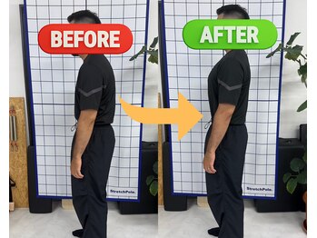 ハビジム(HabiGym)/整体ビフォーアフター