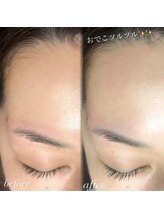 アイラッシュサロン ブラン イオンモール久御山店(Eyelash Salon Blanc)/おでこWAX