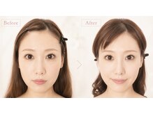 肌質改善ラボの雰囲気（小顔矯正で憧れ立体小顔★全身矯正とのセットで相乗効果◎）