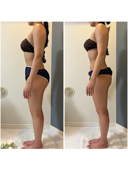 モア(moa)/全身のケア