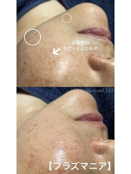 エステルーム クリスタル/【NEW】プラズマニア