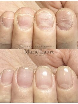 マリーロール 天王寺店(Marie Laure)/自爪育成/深爪矯正/ネイルケア