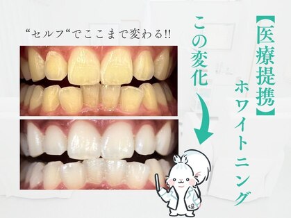 リピカ(RipiQa)の写真