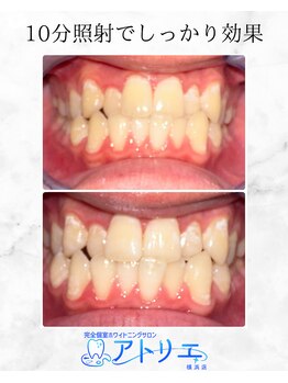 アトリエ 横浜店/ホワイトニングサロン/横浜