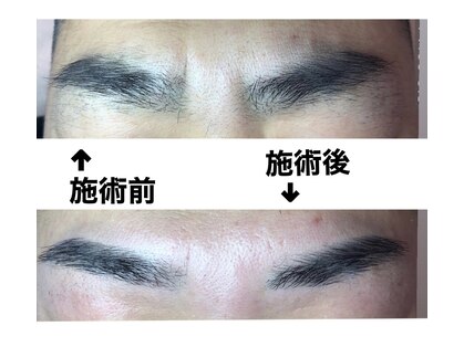 チャーム(CHARM∞)の写真