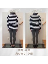 りもあず(ReMore-S)/小顔になりたい/背骨の歪み/０脚