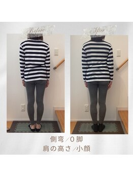 りもあず(ReMore-S)/小顔になりたい/背骨の歪み/0脚