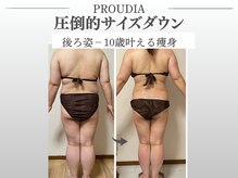 プラウディア(PROUDIA)の雰囲気（ハーブピーリング/HAABREPRO/背中ニキビ/シミ/肌荒/エイジング）