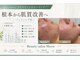 マヴィ(Mavie)の写真