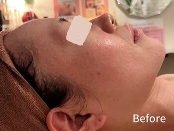 ダイヤモンド リーエンダ(Diamond leende)/クレイハーブピーリング