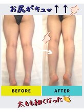 パルファンドゥー(parfum doux)/痩身【下半身】ビフォーアフター