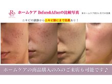 ラボーテアッシュ(La beaute H)