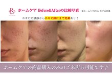 ラボーテアッシュ(La beaute H)