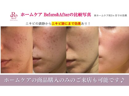 ラボーテアッシュ(La beaute H)の写真