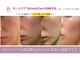 ラボーテアッシュ(La beaute H)の写真