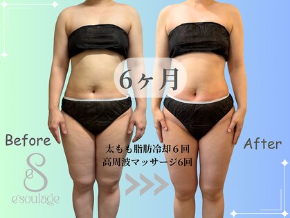 エスラージュ(esoulage)の写真