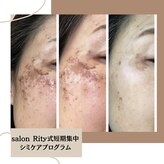 サロン リティー(Salon Rity)