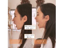 サンテリア(Santelia)の雰囲気（顔の歪みや食いしばりなど顎のお悩みも♪）