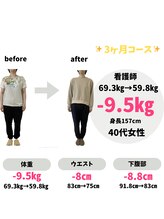 整体院 モンテ(monte)/before＆after