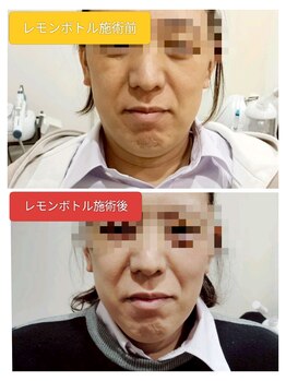 縁(en)/レモンボトルで脂肪分解^_^