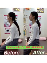 ヒデ整体院(Hide整体院)/猫背矯正骨盤矯正B/A肩こり腰痛