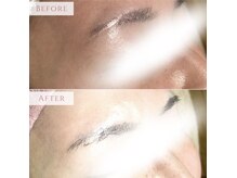 ハナハナ(hanahana)/お肌が赤っぽい