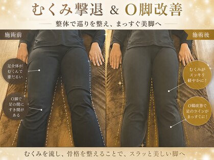 プラスアルファ(PLUSALPHA)の写真
