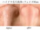 ルーナ 恵比寿(Luna)の写真