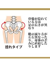 ロコモ 美容矯正サロン(Locomo)/骨盤矯正：捻れタイプ