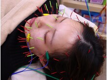 ながれかわ整骨院/しわ・しみ・たるみ・肌荒れ予防