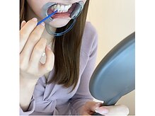 エクシアホワイトニング 今池店/５.歯に溶剤（ジェル）を塗る