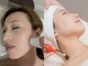 リモーブ(Limauve)の写真/もたつき解消!キュッと引き締め、内側から潤うツヤ肌へ♪《小顔リフトサーマル×LHAララピール90分¥14980》