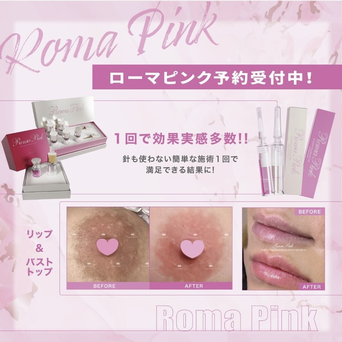 池袋店 大人気エステサロン 美顔器 C047650853.jpg?impolicy=
