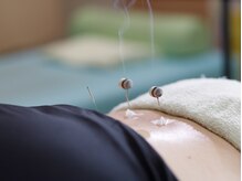 わくわく整骨院の雰囲気（ベテラン鍼灸師在籍◎身体の内側から不調を改善！）